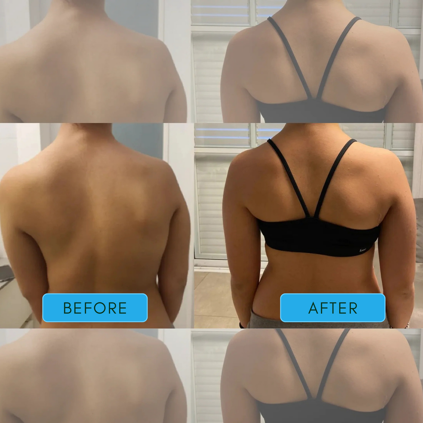 Instant Posture Corrector
